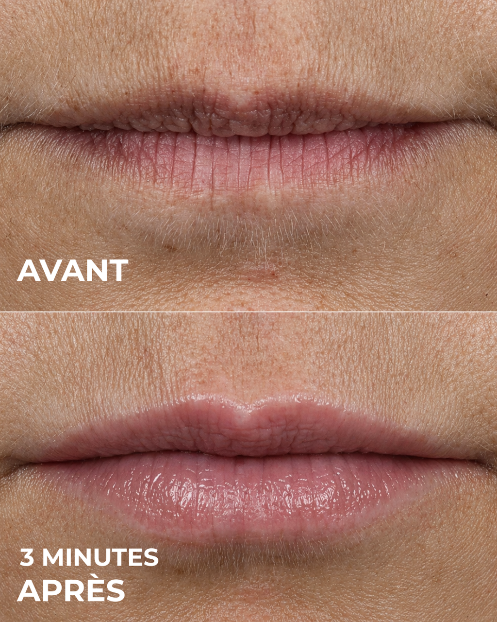 Lip Volume Serum™