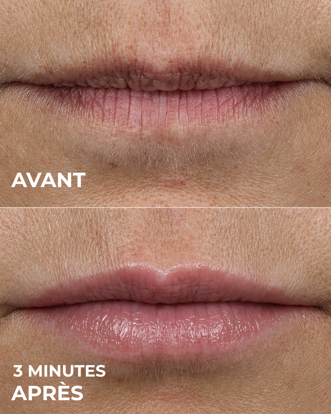 Lip Volume Serum™