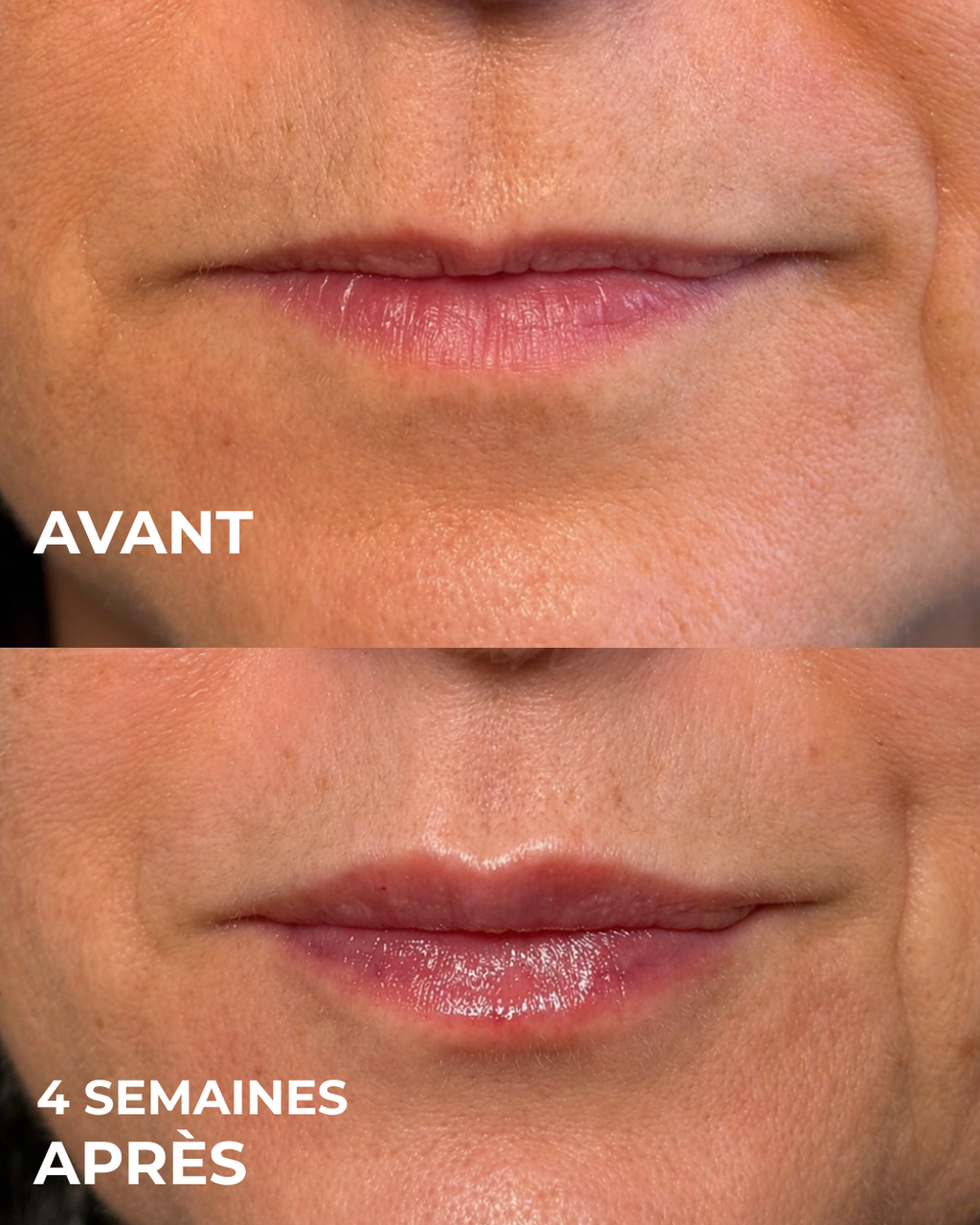 Lip Volume Serum™